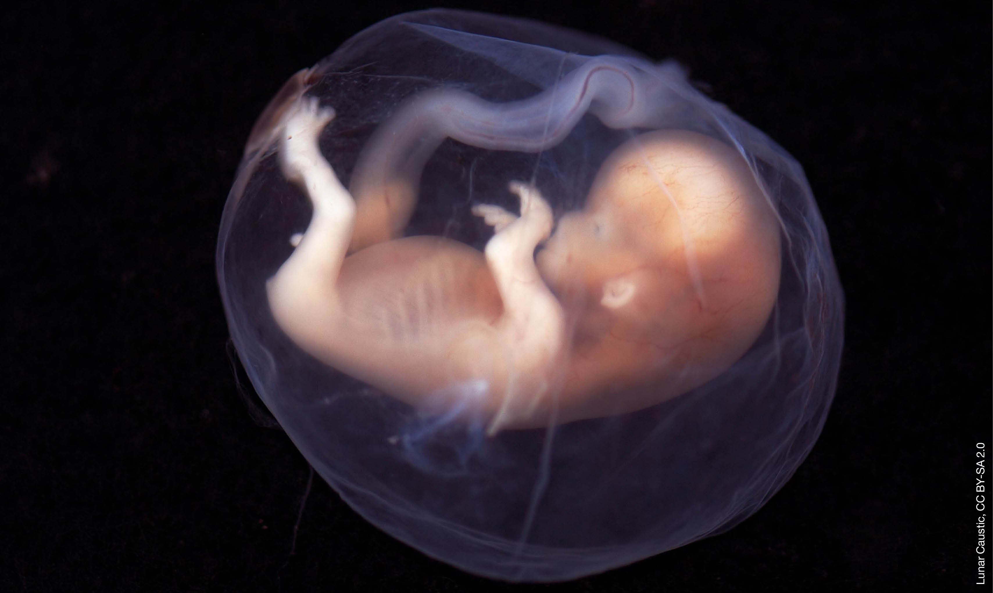 Эмбрион зародыш человека