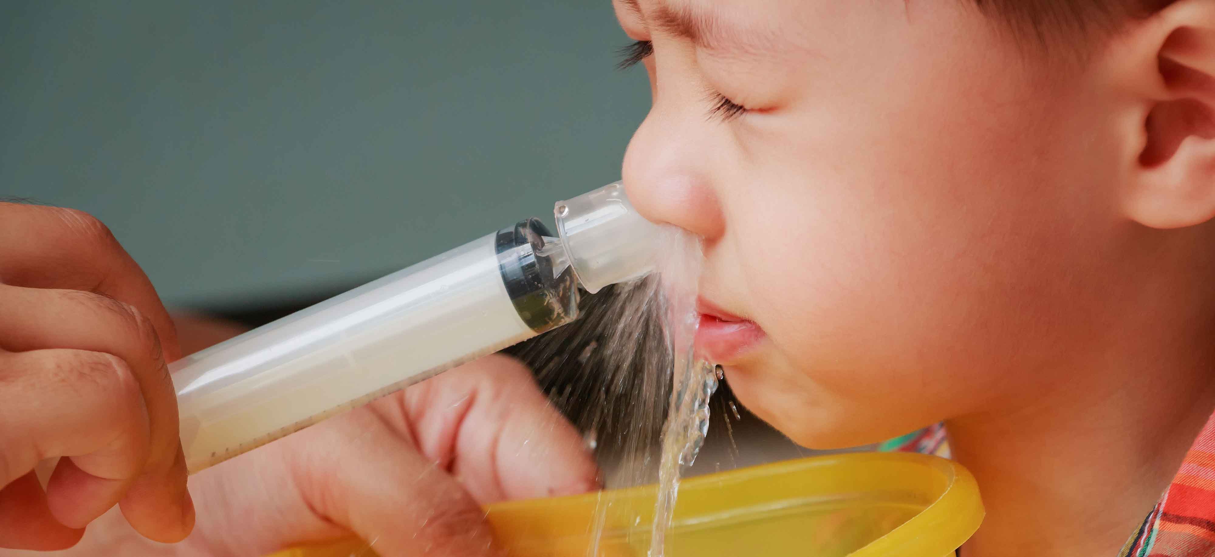 Чем можно увлажнять слизистые. Для промывания носа для детей. Кукушка промывание носа детям. Промывать нос детям. Шприц для промывания носа для детей.