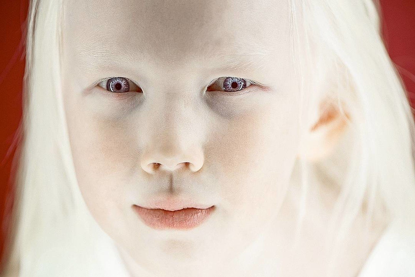 Как люди рождаются альбиносами. Нарияна Сибирская Белоснежка. Глазокожный альбинизм 1 а.