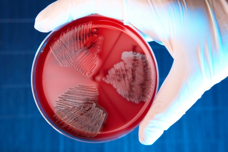 Pseudomonas aeruginosa пигмент