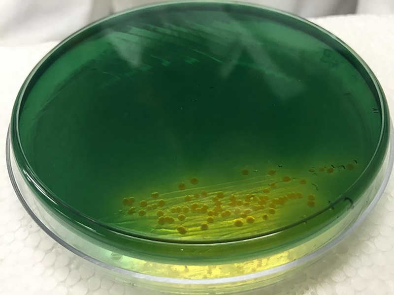 Pseudomonas aeruginosa серовары