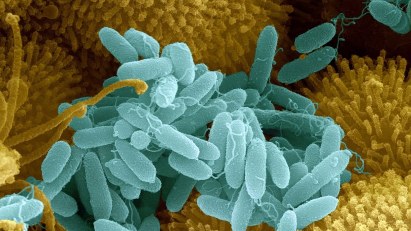 Синегнойная палочка (Pseudomonas);