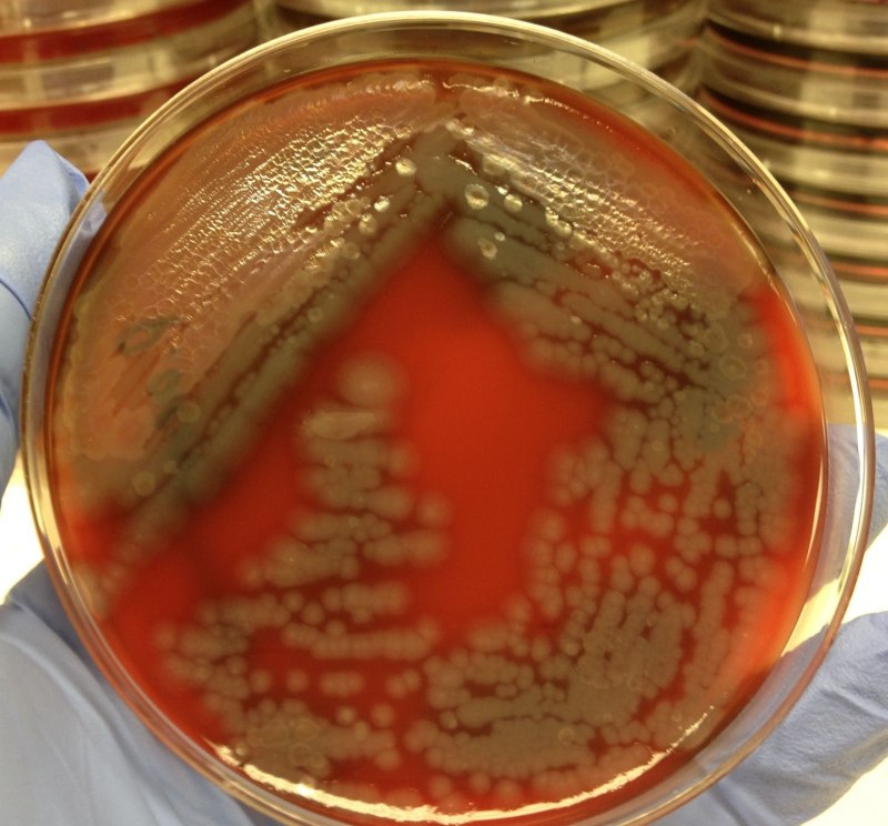 Бактерия Pseudomonas aeruginosa