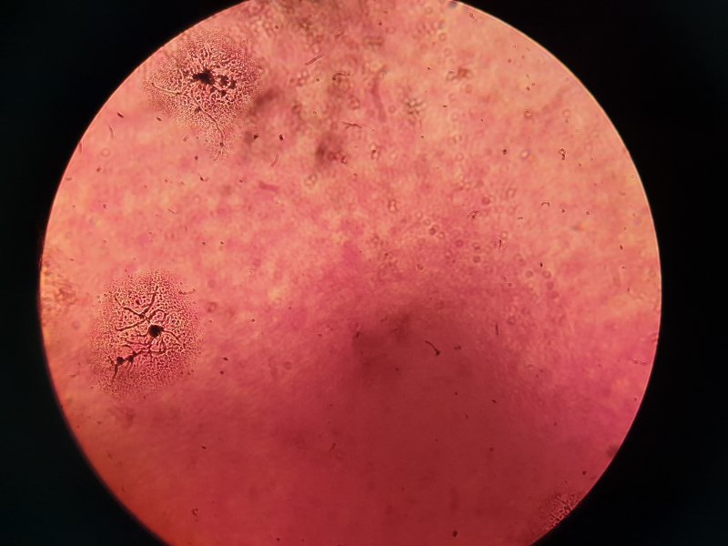 Микроскоп Pseudomonas aeruginosa