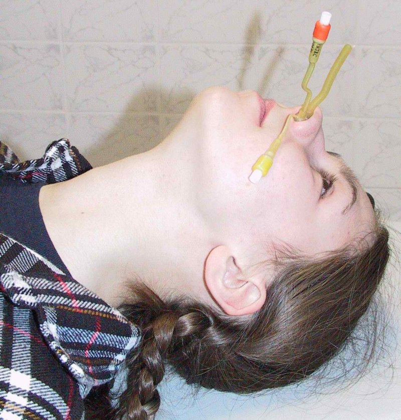 Синус катетер ЯМИК 3