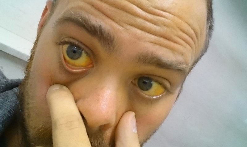 Пятнистая рыжая бабочка