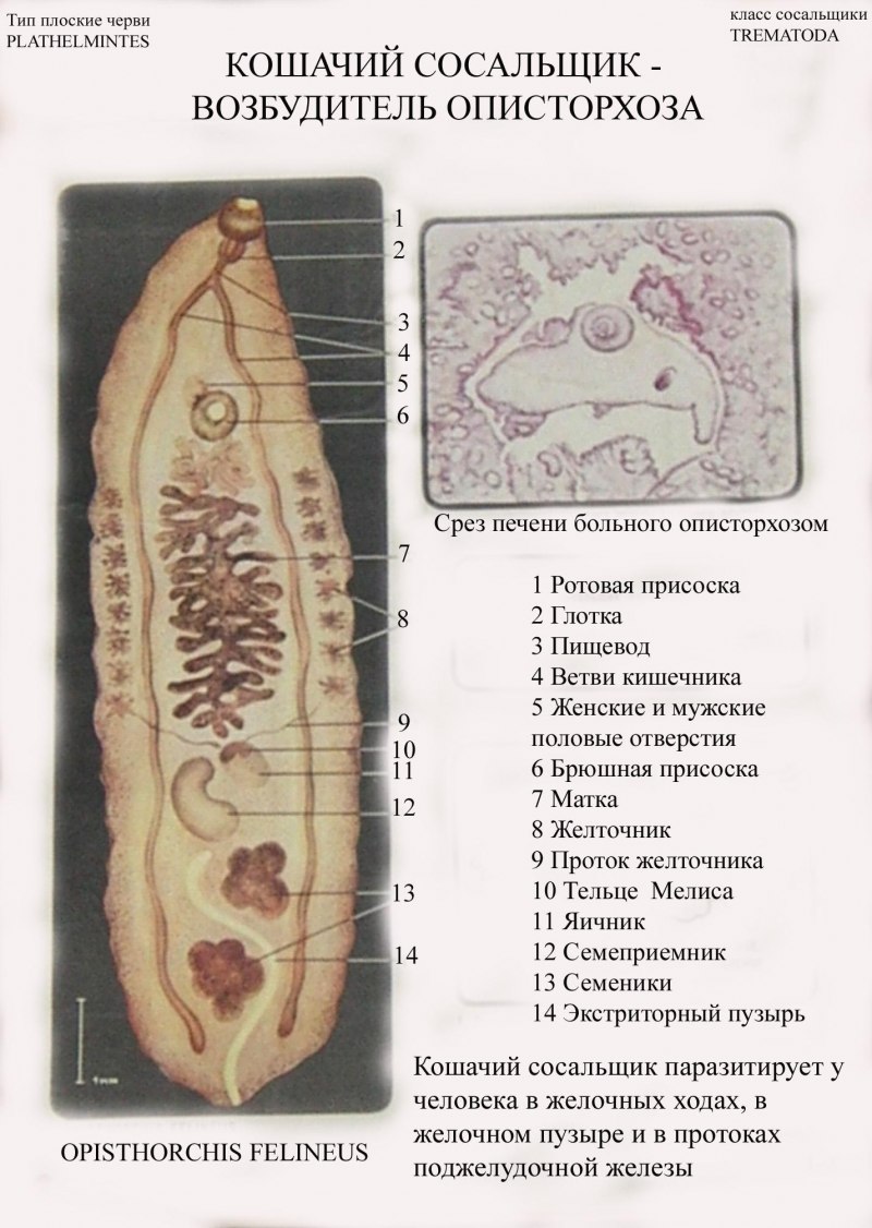 Дикроцелиоз КРС печень