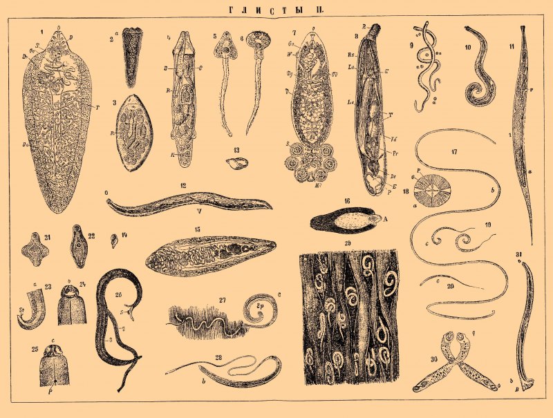 . Paragonimus westermani (легочный сосальщик). Яйцо