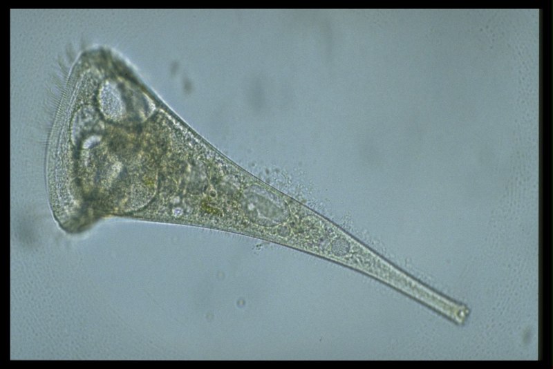 Stentor coeruleus
