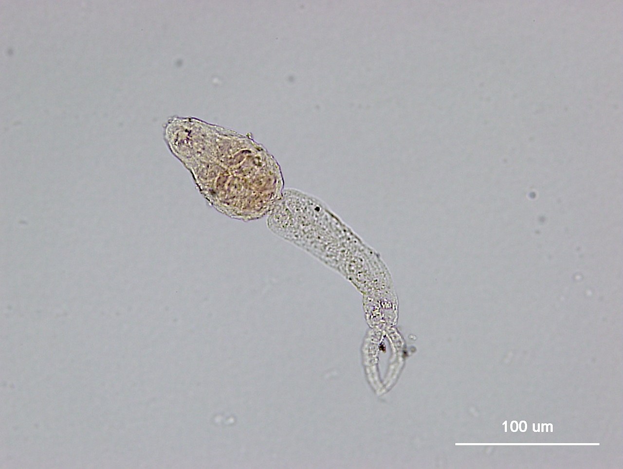 Церкария что это. Schistosoma mansoni яйца. Личинки червей церкарии.