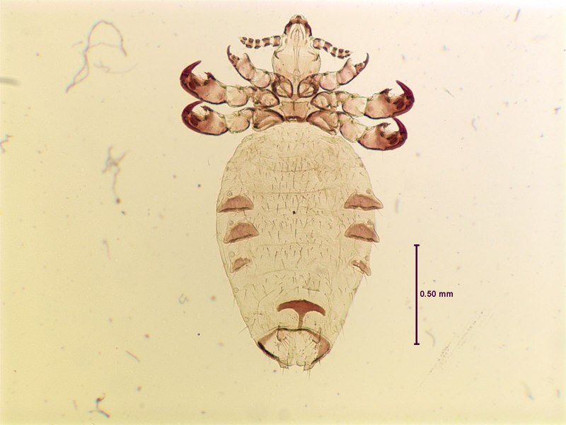 Pediculus humanus humanus возбудитель заболевания