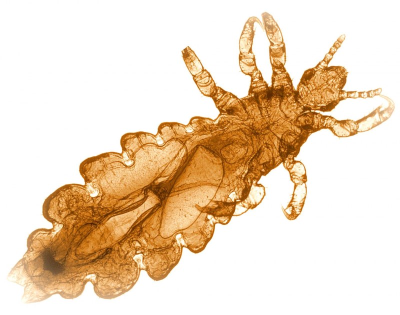 Головная вошь (Pediculus humanus capitis)