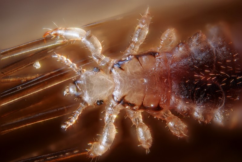 Головная вошь (Pediculus humanus capitis)
