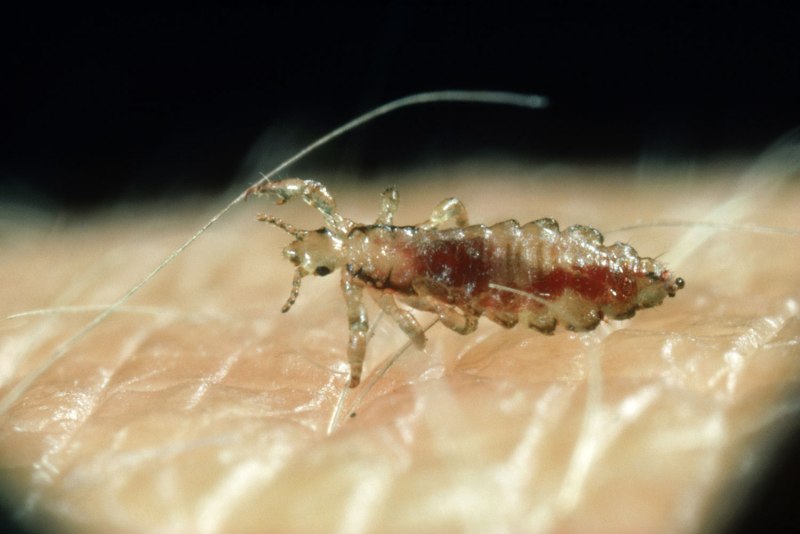 Головная вошь (Pediculus humanus capitis)