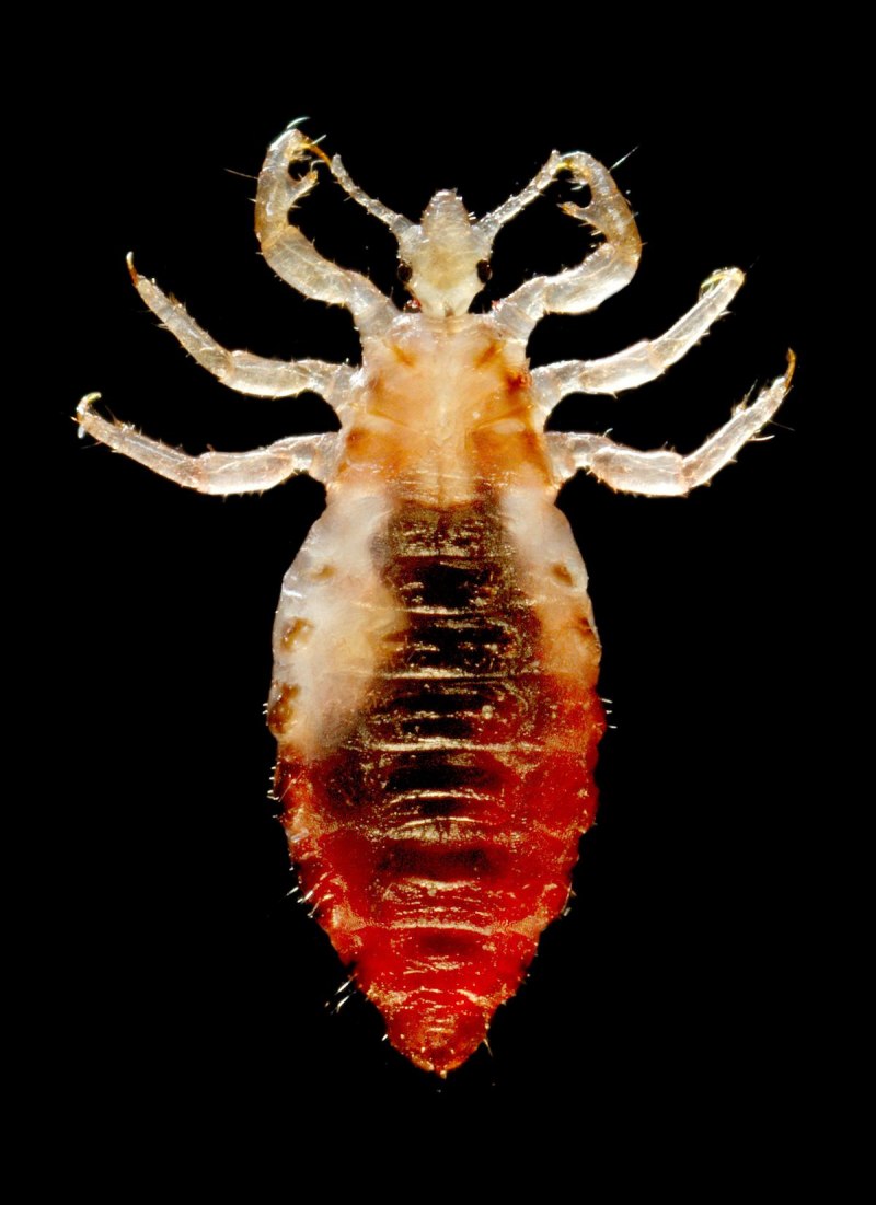 Платяная вошь (Pediculus humanus corporis)
