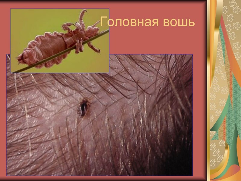 Педикулез головная вошь