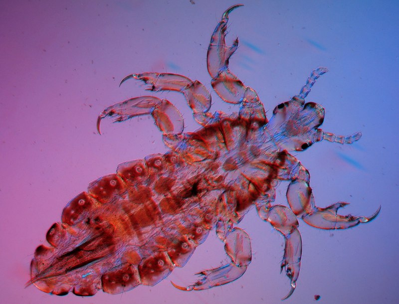 Головная вошь (Pediculus humanus capitis)
