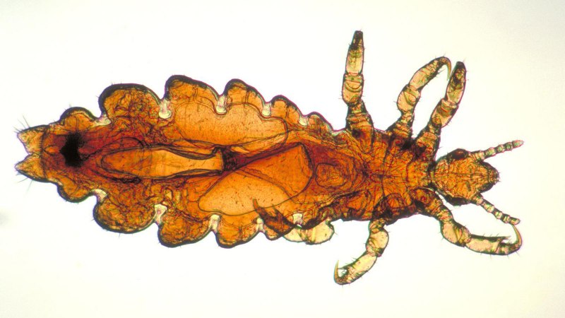 Головная вошь (Pediculus humanus capitis)