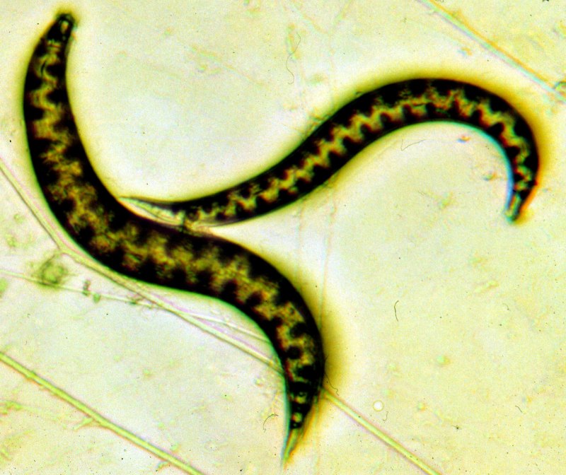 Capillaria hepatica у человека