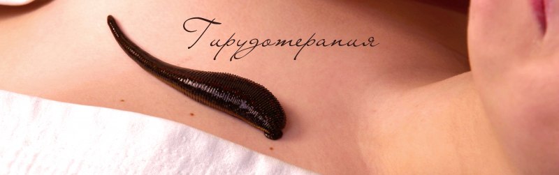Гирудотерапия осложнения
