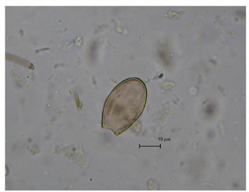 Taeniarhynchus saginatus жизненный цикл
