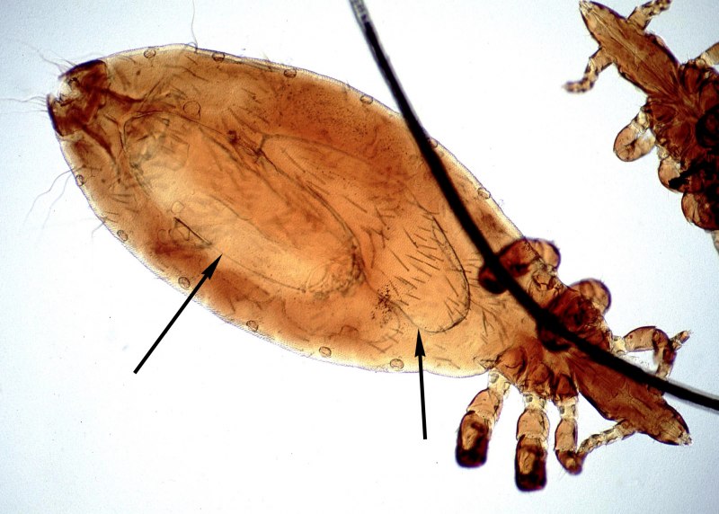 Linognathus setosus