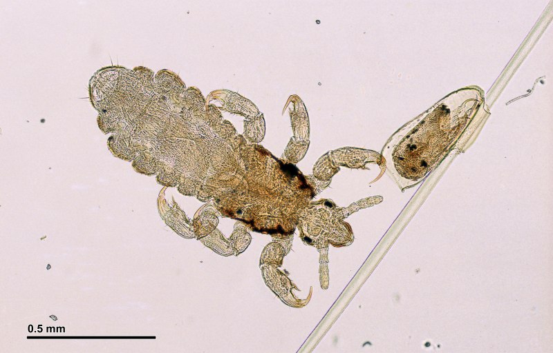 Головная вошь (Pediculus humanus capitis)