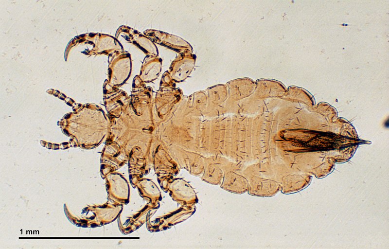 Платяная вошь (Pediculus humanus corporis)
