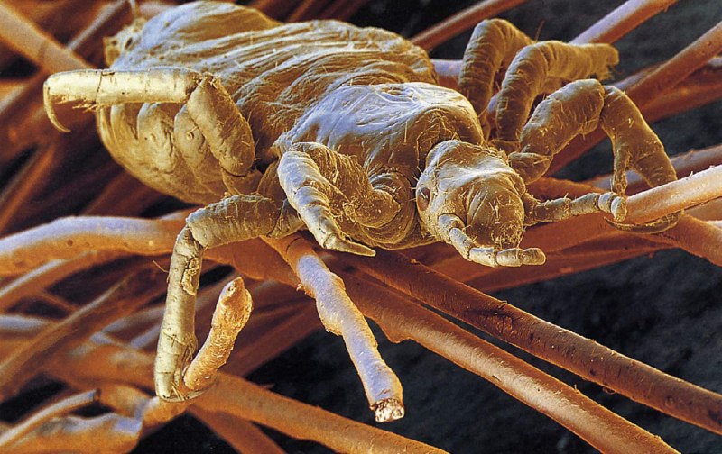 Головная вошь (Pediculus humanus capitis)