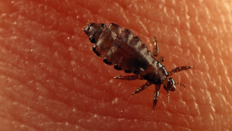 Головная вошь (Pediculus humanus capitis)