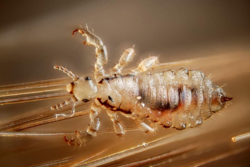 Головная вошь (Pediculus humanus capitis)