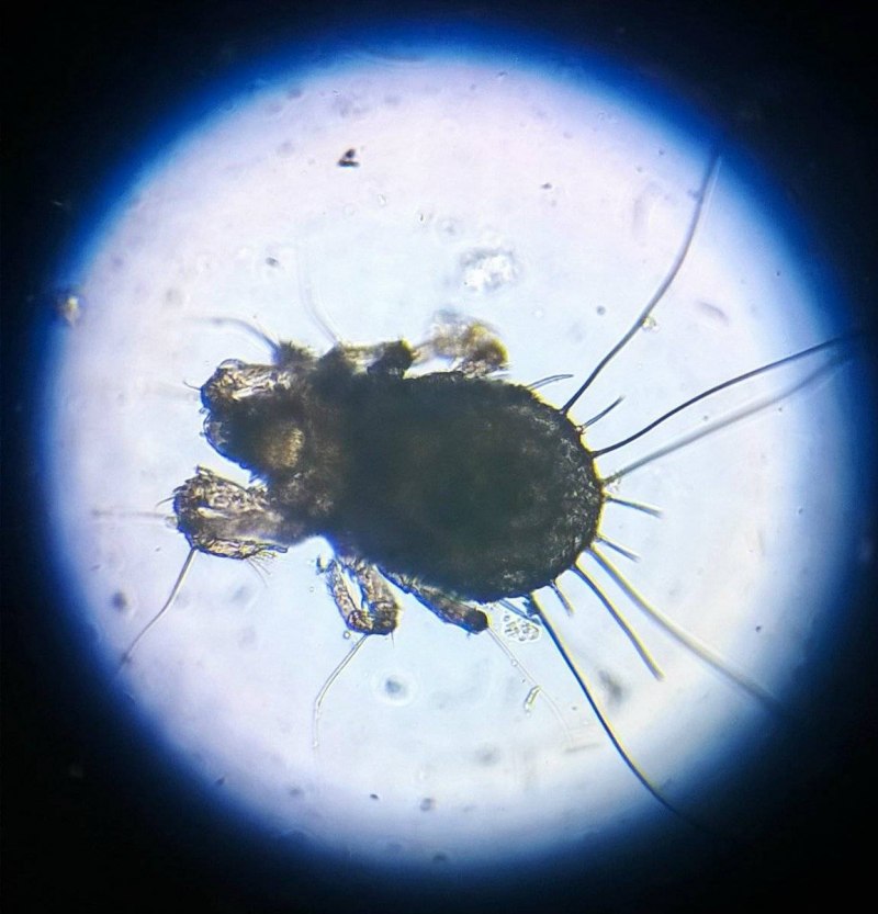 Mesostigmata тритостернум