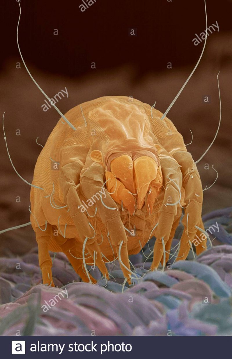 Клещ Dermatophagoides pteronyssinus