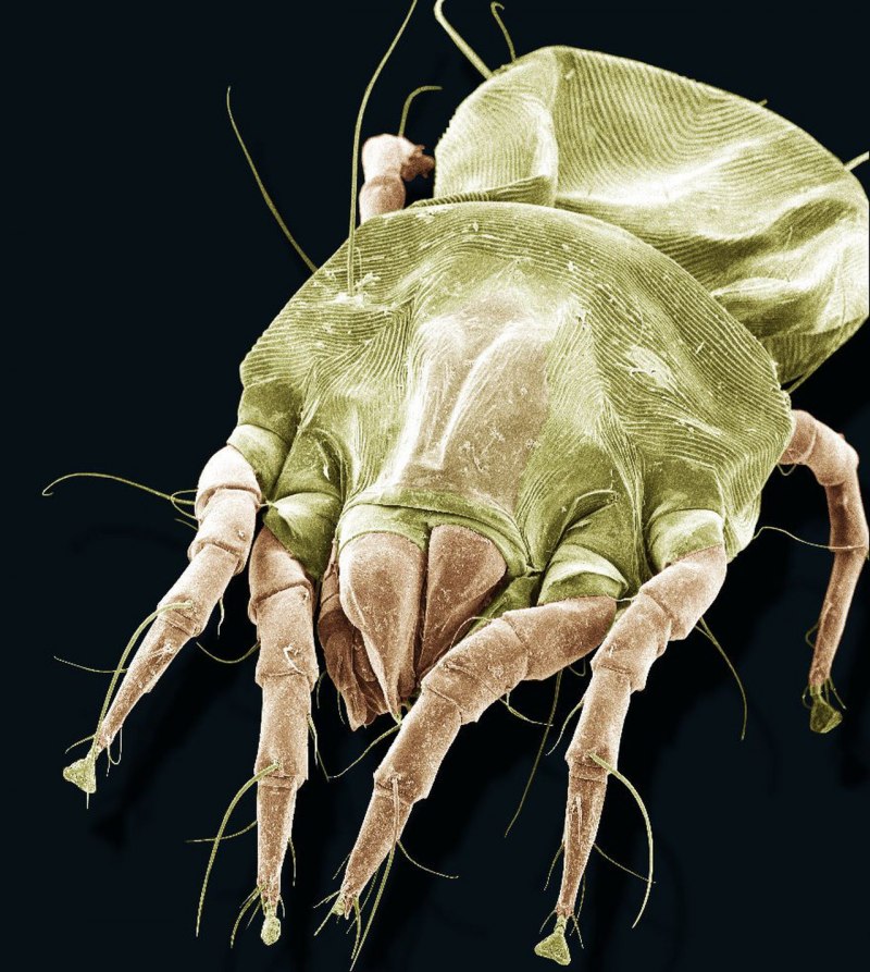 Платяная вошь (Pediculus humanus corporis)