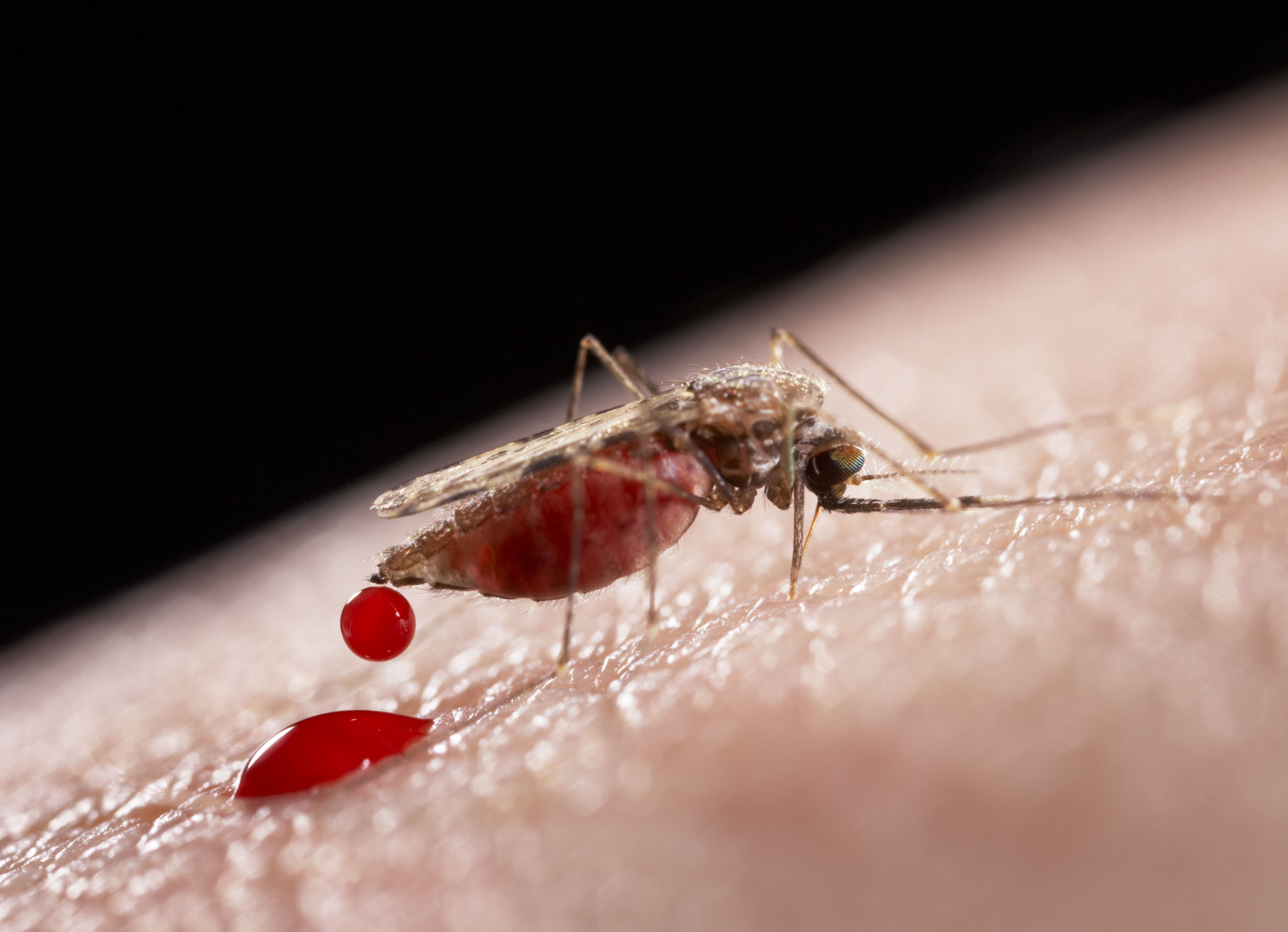 Малярия укусы комаров. Малярийный плазмодий комар. Малярийный комар симптомы. Укус малярии малярийный комар.