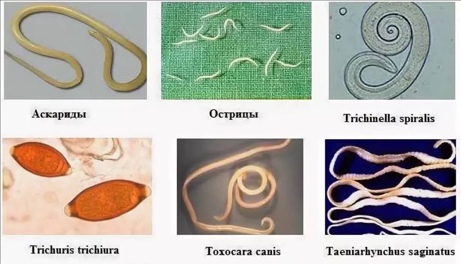 Чем внутренние паразиты отличаются от внутренних паразитов. Аскарида, трихинелла, Острица, власоглав. Аскариды, острицы, трихинелла, фитонематоды. Трихинелла Острица власоглав. Острицы лямблии аскариды.