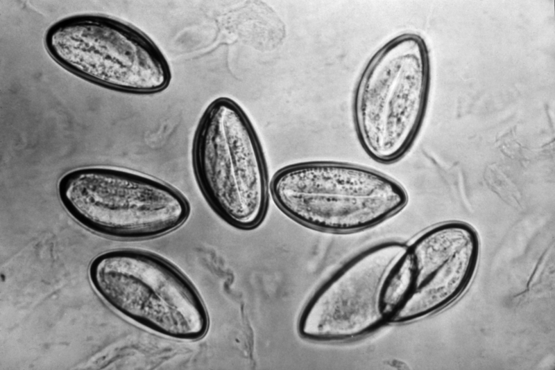 Enterobius vermicularis яйца