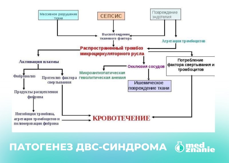 Механизм развития 1 стадии ДВС синдрома