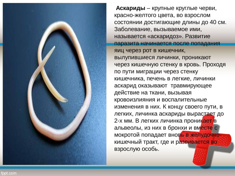 Аскариды крупные круглые черви