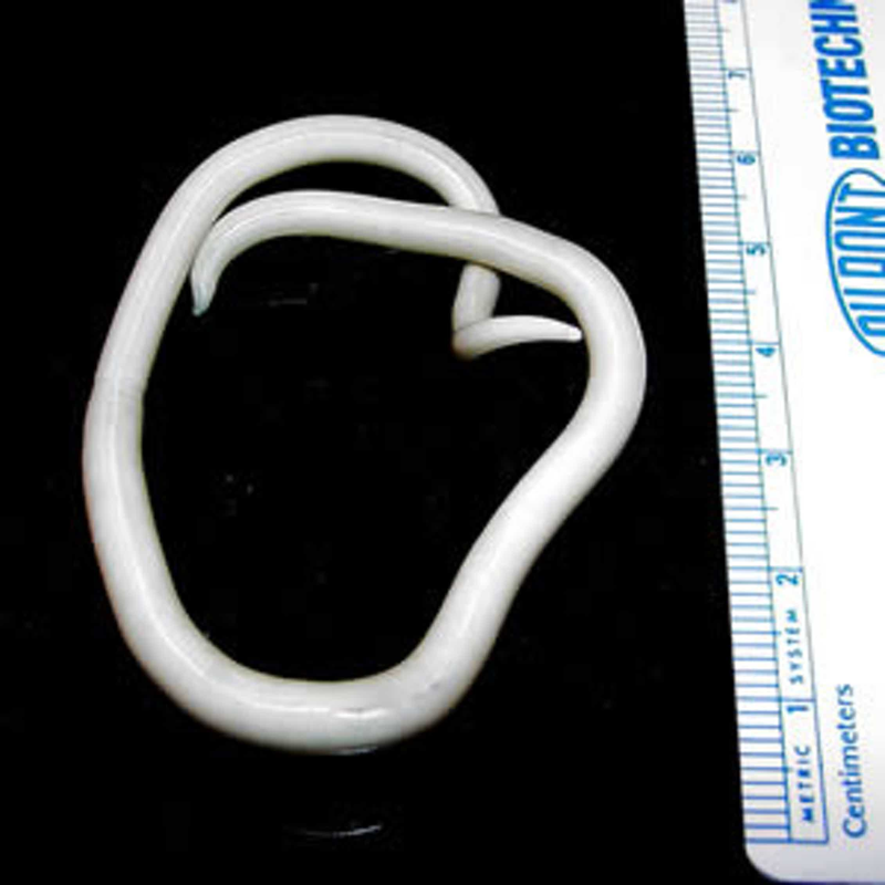 Аскарида (Ascaris lumbricoides) IGG