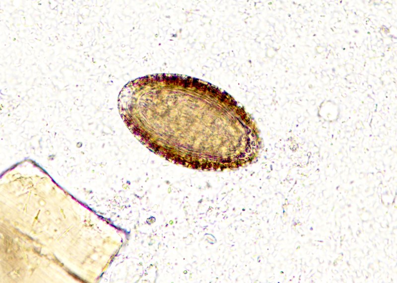 Macracanthorhynchus hirudinaceus