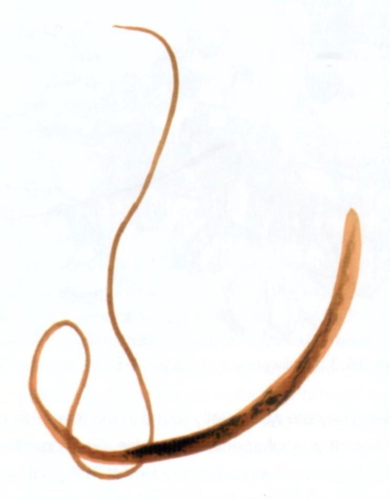 Trichuris Vulpis у человека