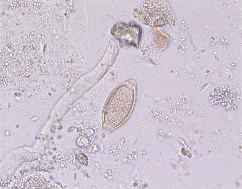Trichuris Vulpis