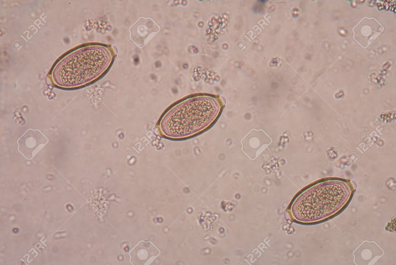 Trichocephalus Trichiurus под микроскопом
