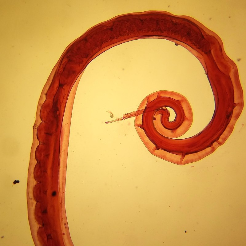 Trichuris Vulpis у человека