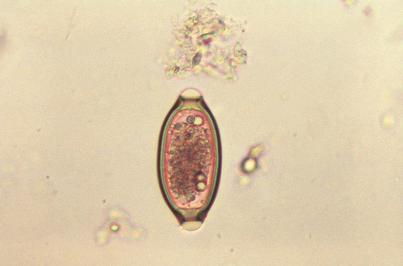 Власоглав trichiuris trichiuria человеческий