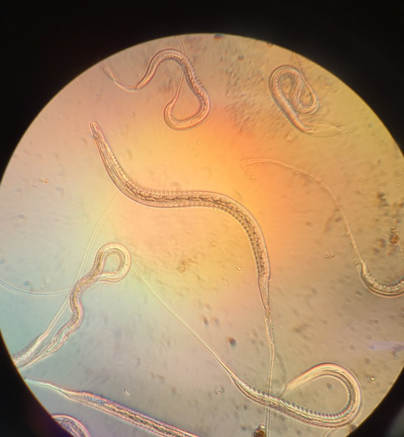Strongyloides stercoralis (угрица)