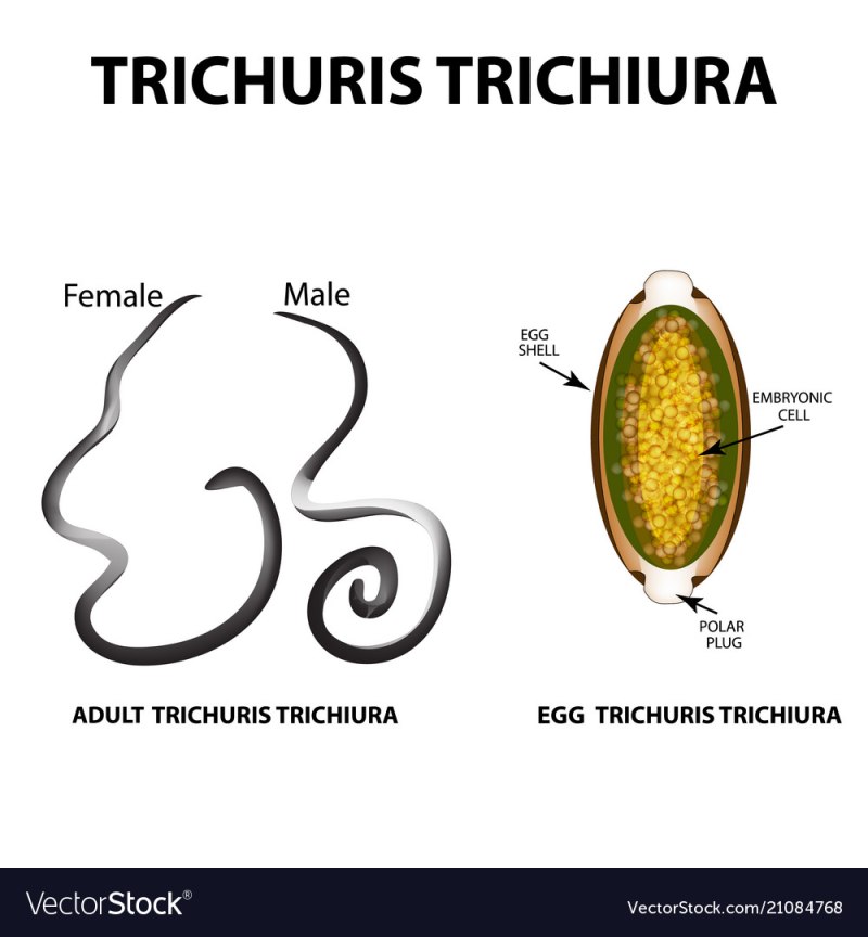 Trichuris trichiura строение