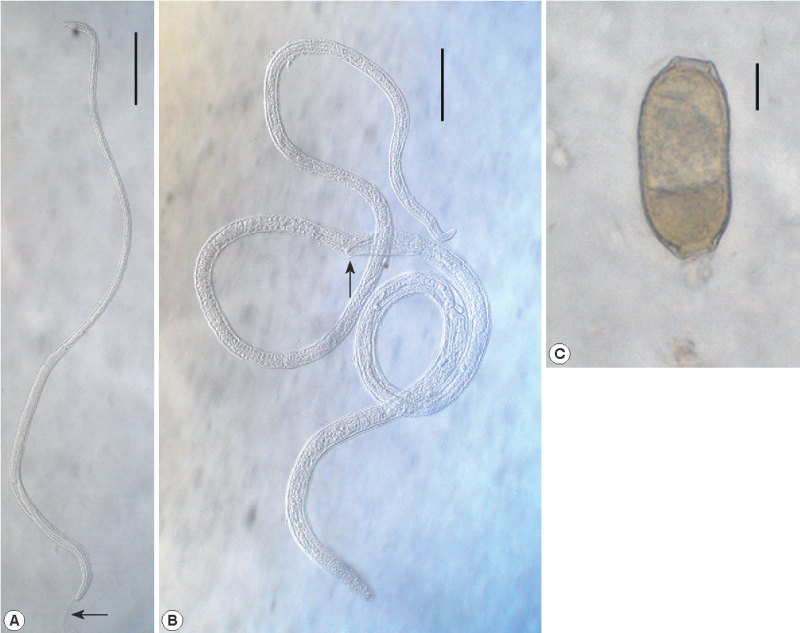 Capillaria philippinensis