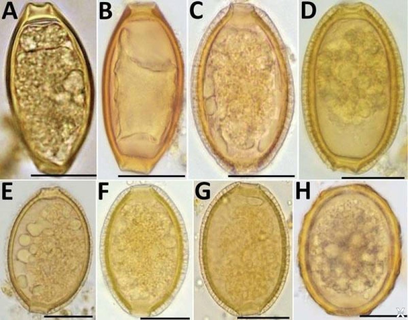 Capillaria Plica яйца
